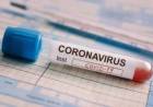 CORONAVIRUS: ARGENTINA SE ACERCA AL MILLÓN Y MEDIO DE CONTAGIOS