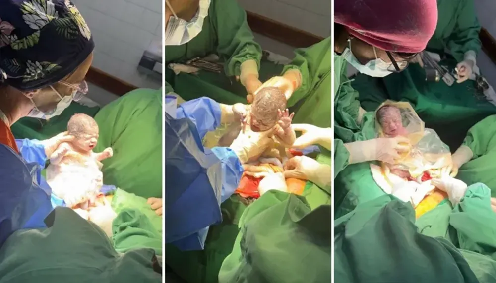 NACIERON TRIGEMELAS EN SALTA: UN CASO ENTRE UN MILLÓN DE EMBARAZOS