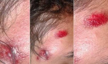 EN ENTRE RÍOS, OCHO POLICÍAS PRESOS POR TORTURAR A UN CHICO: "GUANACO, DEJÁ DE ESTAR ESCUPIENDO"