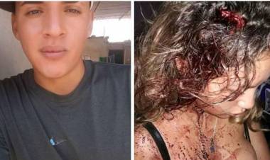 SALTEÑO ATACÓ BRUTALMENTE A SU PAREJA 