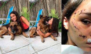 EN TUCUMÁN UNA JOVEN SE FOTOGRAFIÓ CON LA PERRA DE SU AMIGO Y TERMINÓ CON MÁS DE 20 PUNTOS EN LA CARA
