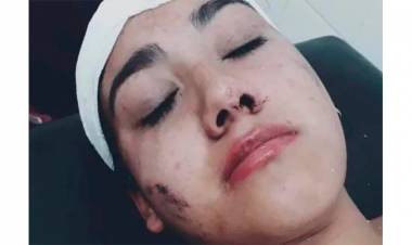 UNA JOVEN FUE ATACADA EN SANTA FE POR UNA PATOTA EN UN BOLICHE
