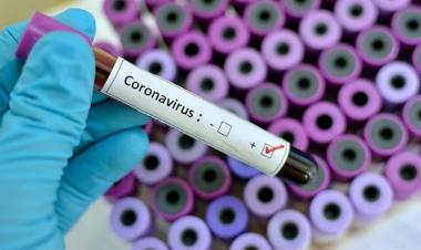 CORONAVIRUS EN ARGENTINA: ESTE DOMINGO CONFIRMARON 41 NUEVOS CASOS Y EL TOTAL ES 266 EN EL PAÍS