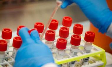 CONFIRMAN 36 NUEVOS CASOS DE CORONAVIRUS EN EL PAÍS Y LOS INFECTADOS SON 301