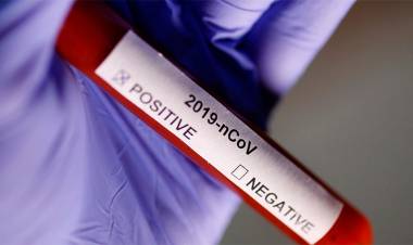 SON 1.715 LOS CASOS CONFIRMADOS Y 60 LOS MUERTOS POR CORONAVIRUS EN ARGENTINA