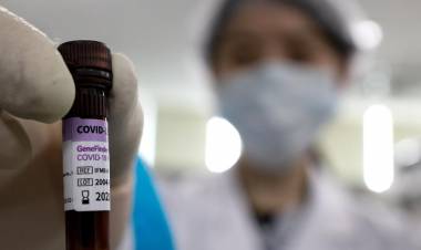 SAN LUIS: SE CONFIRMÓ UN NUEVO CASO POSITIVO DE CORONAVIRUS EN LA PROVINCIA