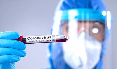 SAN LUIS: ESTE MARTES SE REGISTRÓ UN NUEVO CASO POSITIVO DE CORONAVIRUS