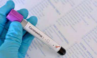 ESTE SÁBADO SE CONFIRMARON 12 NUEVOS CASOS DE CORONAVIRUS EN SAN LUIS