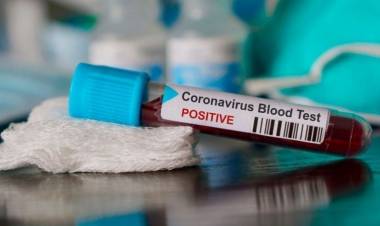 CORONAVIRUS EN SAN LUIS: ESTE VIERNES SE REGISTRARON 41 CASOS POSITIVOS Y SE CONFIRMÓ LA CUARTA MUERTE EN LA PROVINCIA