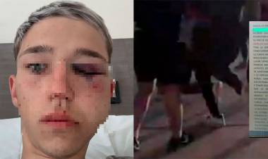 MENDOZA: IDENTIFICARON A LOS RUGBIERS ACUSADOS DE GOLPEAR A UN MENOR EN UNA FIESTA DE 15