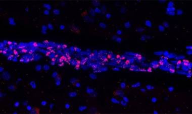 NUEVO DESCUBRIMIENTO: COVID-19 PROVOCA LA MUERTE DE IMPORTANTES CÉLULAS DEL SISTEMA VASCULAR CEREBRAL