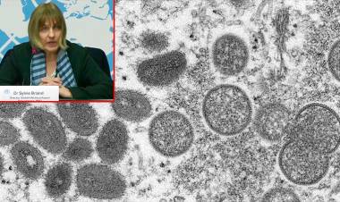 LOS CASOS DE VIRUELA DEL MONO PODRÍAN SER LA "PUNTA DEL ICEBERG" ES LO QUE MANIFIESTA LA OMS