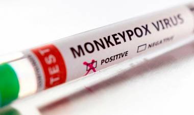 LA OMS RATIFICÓ QUE NO RECOMIENDA LA VACUNACIÓN MASIVA CONTRA VIRUELA DEL MONO