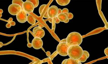 PRIMEROS DOS CASOS CANDIDA AURIS EN ARGENTINA: LO QUE SE SABE DEL “SÚPER HONGO”