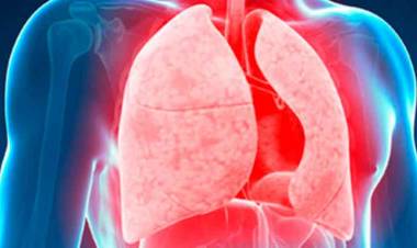 CONICET AVANZA EN NUEVA HERRAMIENTA PARA DIAGNOSTICAR LA TUBERCULOSIS