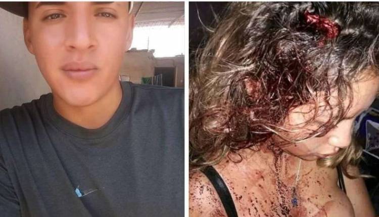 SALTEÑO ATACÓ BRUTALMENTE A SU PAREJA 