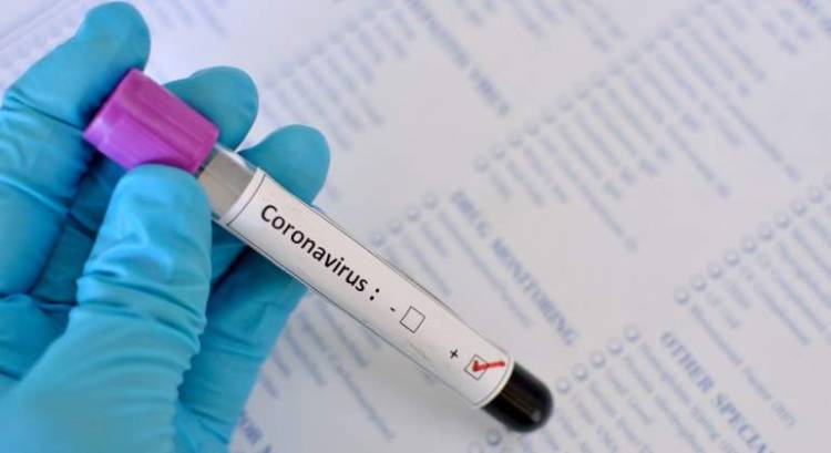 ESTE SÁBADO SE CONFIRMARON 12 NUEVOS CASOS DE CORONAVIRUS EN SAN LUIS
