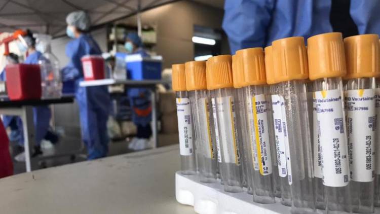 CORONAVIRUS EN SAN LUIS: HOY SE REGISTRARON 129 CASOS, 84 SON DE VILLA MERCEDES QUE ES LA CIUDAD CON MÁS CONTAGIOS