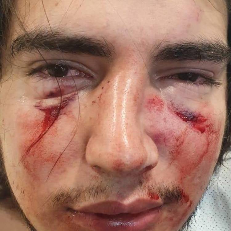 CUATRO RUGBIERS FUERON DENUNCIADOS POR UNA BRUTAL GOLPIZA A UN JOVEN EN CÓRDOBA